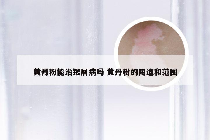 黄丹粉能治银屑病吗 黄丹粉的用途和范围