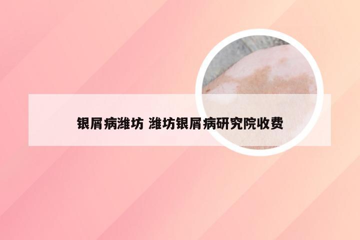 银屑病潍坊 潍坊银屑病研究院收费