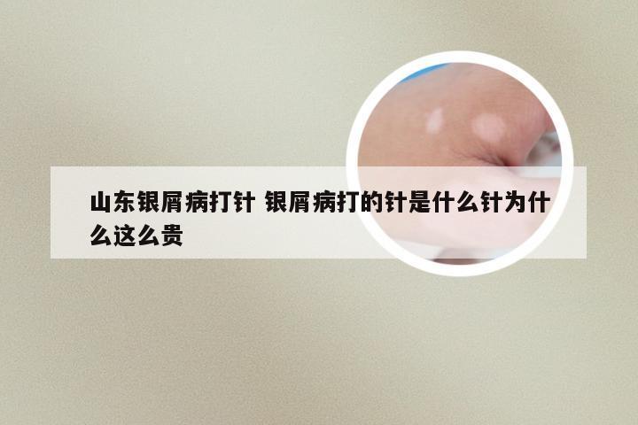 山东银屑病打针 银屑病打的针是什么针为什么这么贵