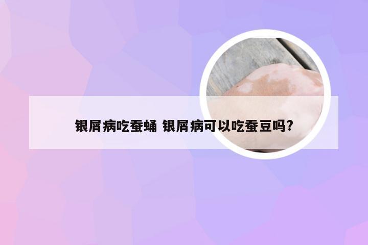 银屑病吃蚕蛹 银屑病可以吃蚕豆吗?
