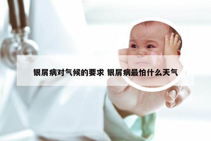 银屑病对气候的要求 银屑病最怕什么天气