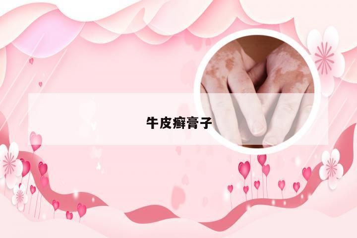 牛皮癣膏子