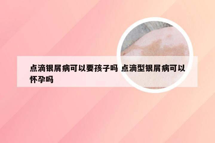 点滴银屑病可以要孩子吗 点滴型银屑病可以怀孕吗