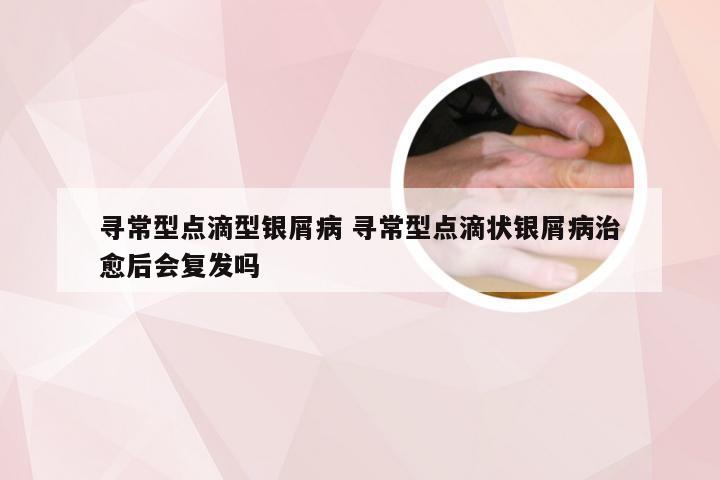寻常型点滴型银屑病 寻常型点滴状银屑病治愈后会复发吗
