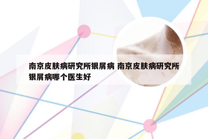 南京皮肤病研究所银屑病 南京皮肤病研究所银屑病哪个医生好