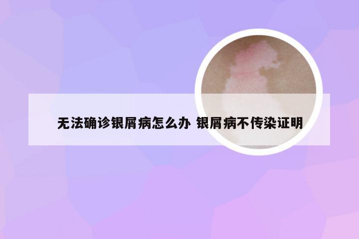 无法确诊银屑病怎么办 银屑病不传染证明