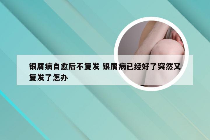 银屑病自愈后不复发 银屑病已经好了突然又复发了怎办