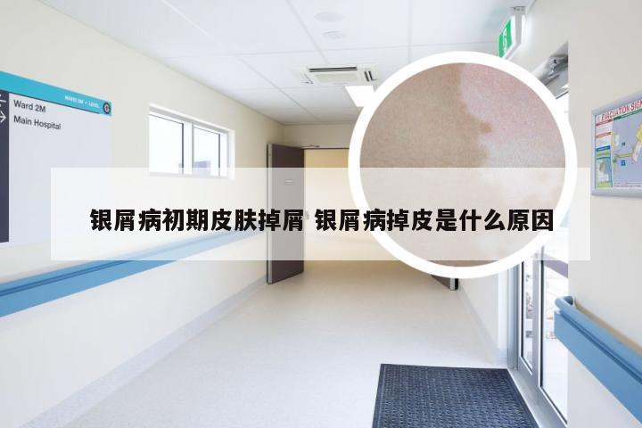 银屑病初期皮肤掉屑 银屑病掉皮是什么原因