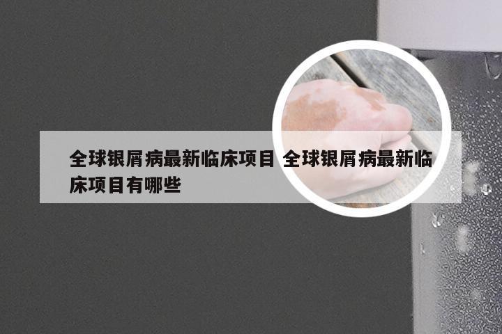 全球银屑病最新临床项目 全球银屑病最新临床项目有哪些