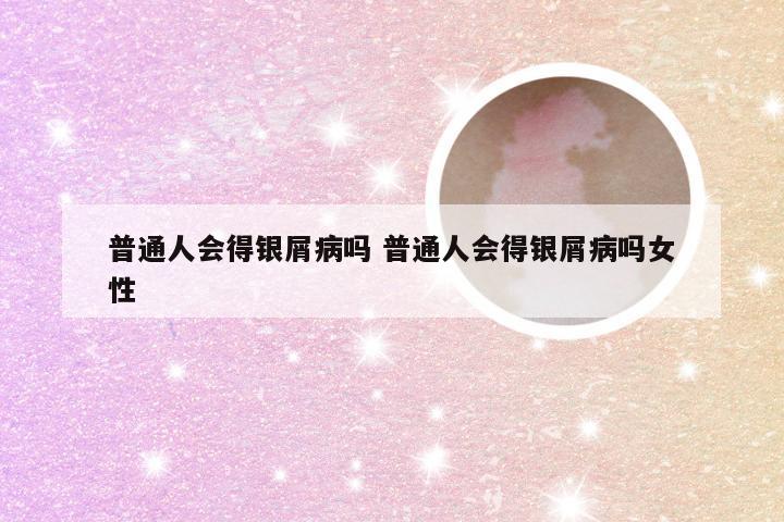 普通人会得银屑病吗 普通人会得银屑病吗女性