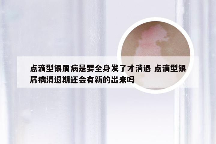 点滴型银屑病是要全身发了才消退 点滴型银屑病消退期还会有新的出来吗