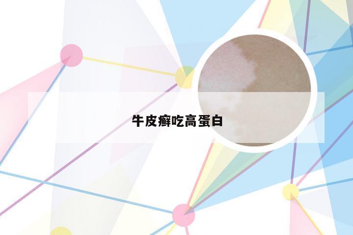 牛皮癣吃高蛋白