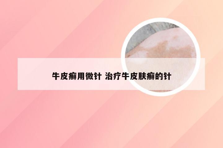 牛皮癣用微针 治疗牛皮肤癣的针
