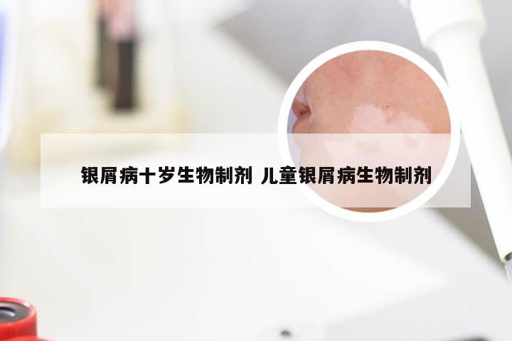 银屑病十岁生物制剂 儿童银屑病生物制剂
