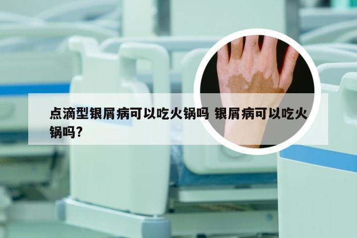 点滴型银屑病可以吃火锅吗 银屑病可以吃火锅吗?