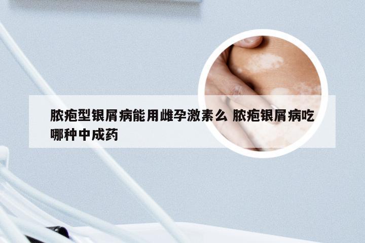 脓疱型银屑病能用雌孕激素么 脓疱银屑病吃哪种中成药