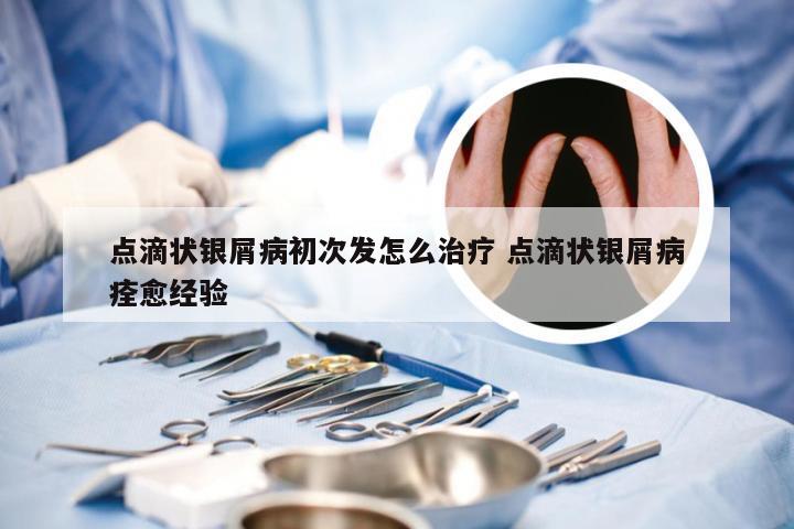 点滴状银屑病初次发怎么治疗 点滴状银屑病痊愈经验