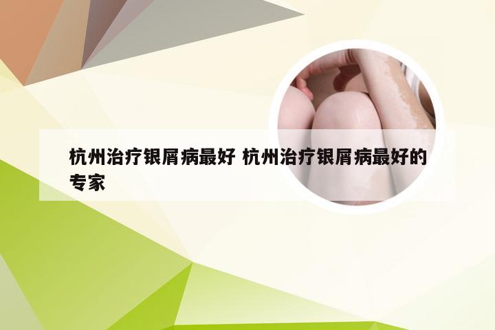 杭州治疗银屑病最好 杭州治疗银屑病最好的专家