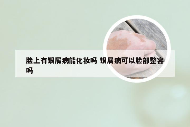 脸上有银屑病能化妆吗 银屑病可以脸部整容吗