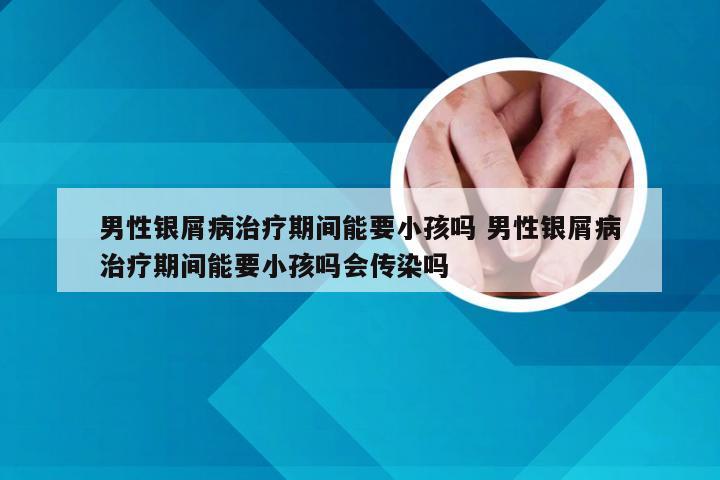 男性银屑病治疗期间能要小孩吗 男性银屑病治疗期间能要小孩吗会传染吗
