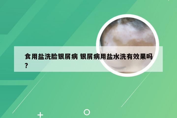 食用盐洗脸银屑病 银屑病用盐水洗有效果吗?