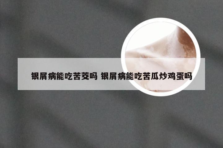银屑病能吃苦茭吗 银屑病能吃苦瓜炒鸡蛋吗