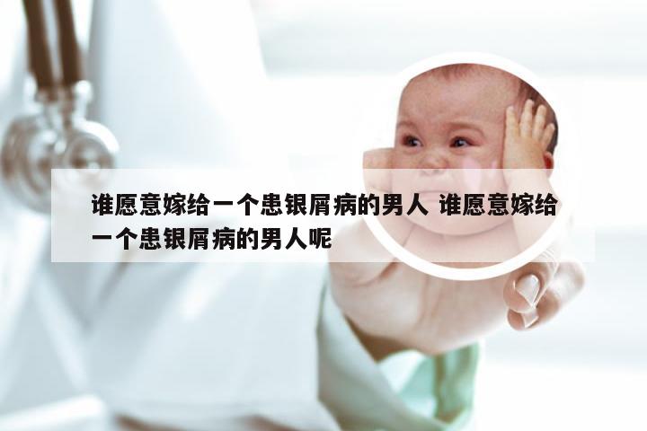 谁愿意嫁给一个患银屑病的男人 谁愿意嫁给一个患银屑病的男人呢