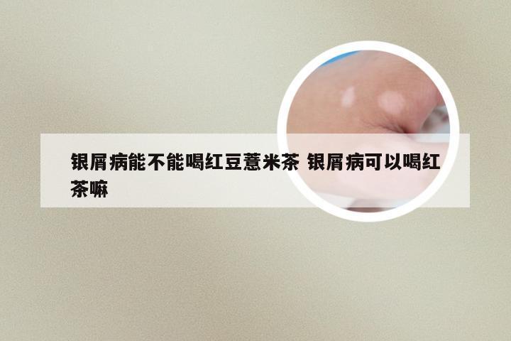 银屑病能不能喝红豆薏米茶 银屑病可以喝红茶嘛