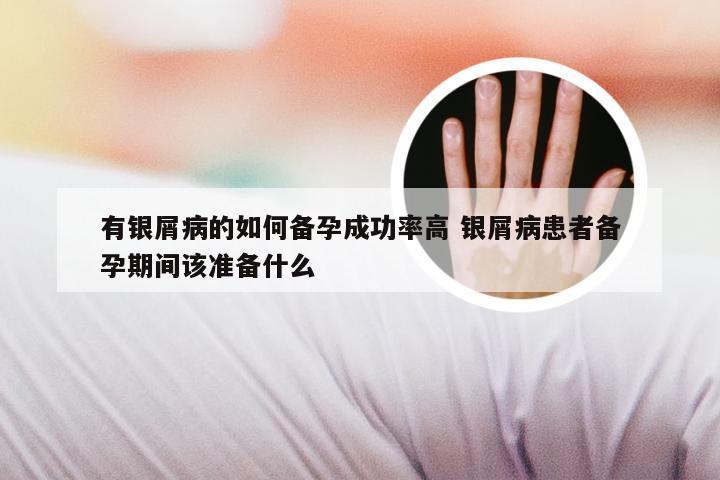 有银屑病的如何备孕成功率高 银屑病患者备孕期间该准备什么