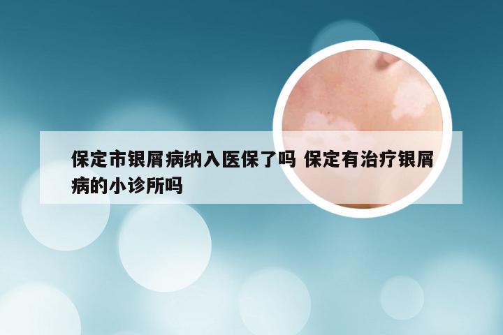 保定市银屑病纳入医保了吗 保定有治疗银屑病的小诊所吗
