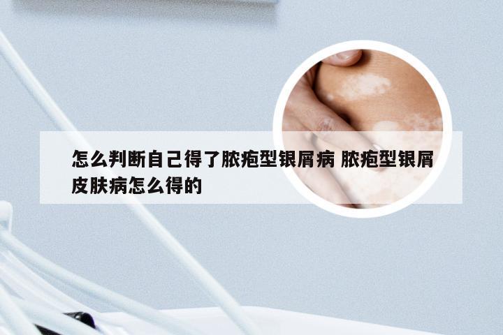 怎么判断自己得了脓疱型银屑病 脓疱型银屑皮肤病怎么得的