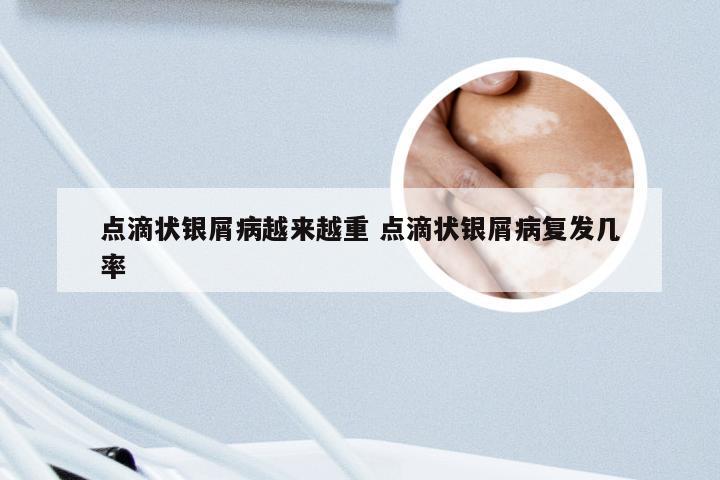 点滴状银屑病越来越重 点滴状银屑病复发几率