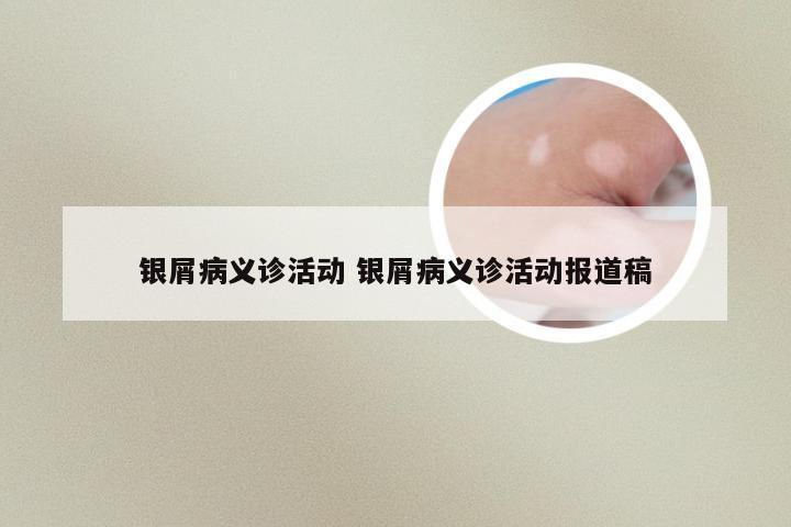 银屑病义诊活动 银屑病义诊活动报道稿