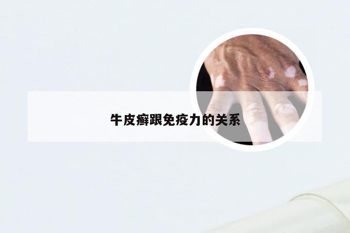 牛皮癣跟免疫力的关系