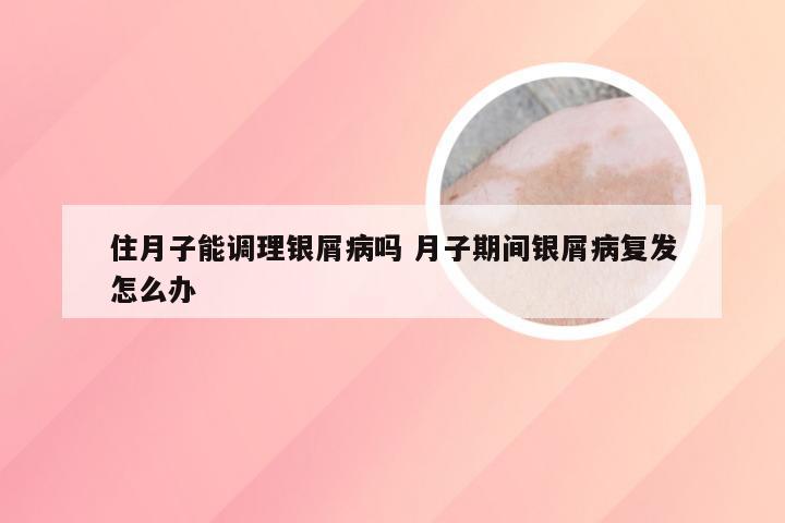住月子能调理银屑病吗 月子期间银屑病复发怎么办