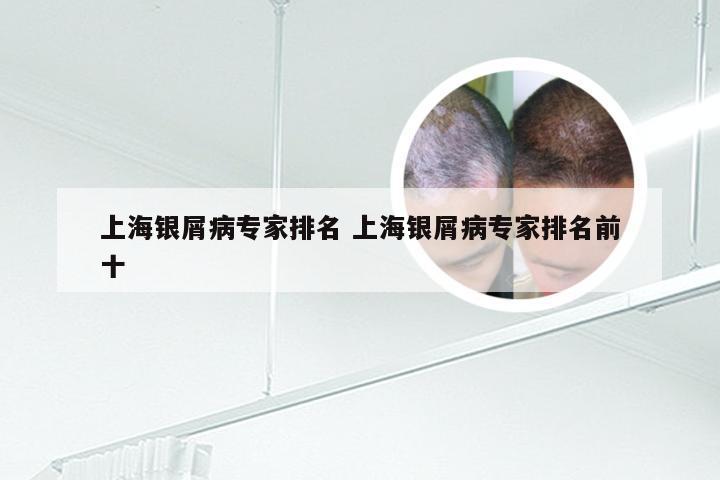 上海银屑病专家排名 上海银屑病专家排名前十