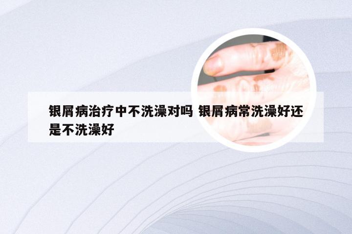 银屑病治疗中不洗澡对吗 银屑病常洗澡好还是不洗澡好