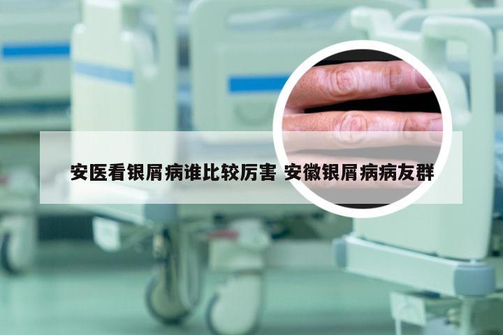 安医看银屑病谁比较厉害 安徽银屑病病友群