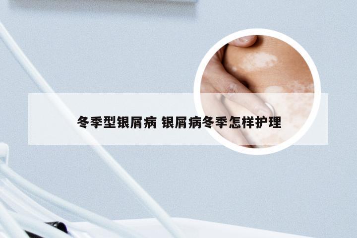 冬季型银屑病 银屑病冬季怎样护理