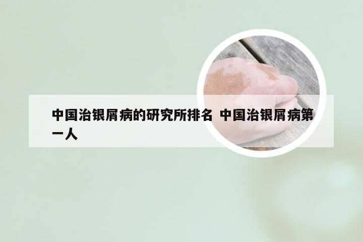 中国治银屑病的研究所排名 中国治银屑病第一人
