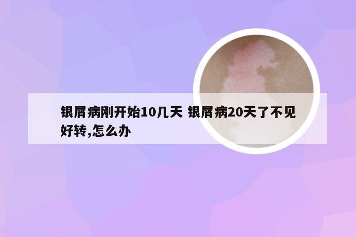 银屑病刚开始10几天 银屑病20天了不见好转,怎么办
