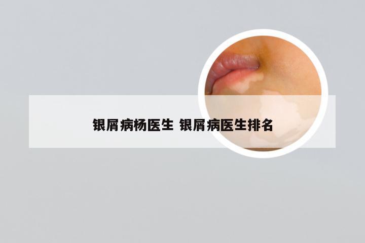 银屑病杨医生 银屑病医生排名