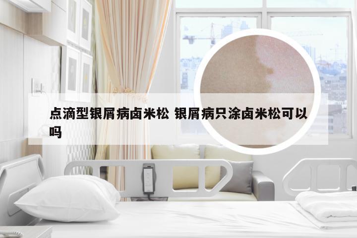 点滴型银屑病卤米松 银屑病只涂卤米松可以吗