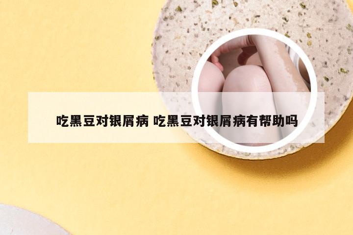 吃黑豆对银屑病 吃黑豆对银屑病有帮助吗