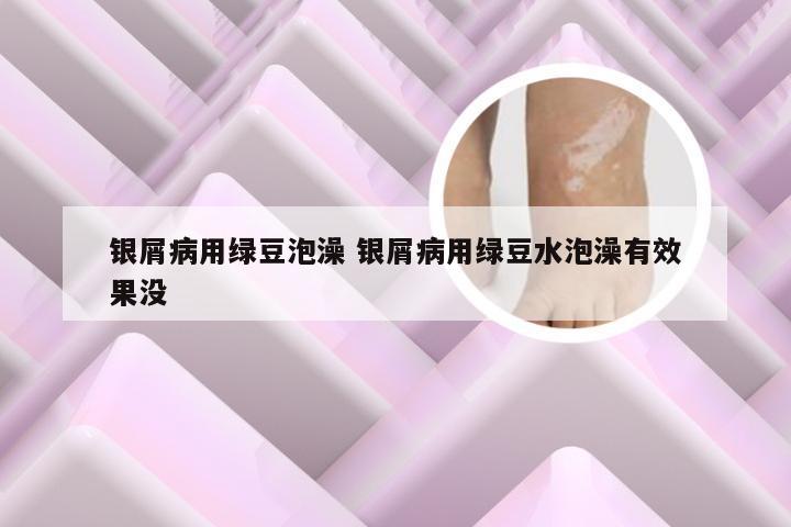 银屑病用绿豆泡澡 银屑病用绿豆水泡澡有效果没