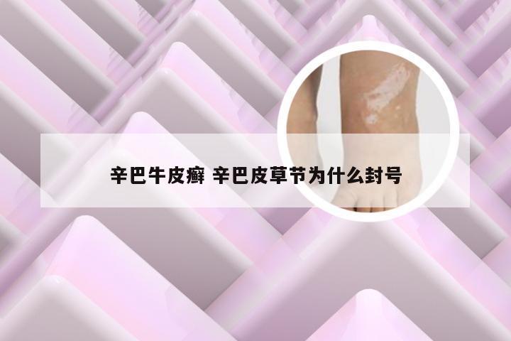 辛巴牛皮癣 辛巴皮草节为什么封号