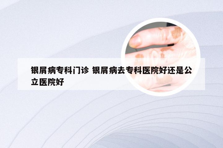 银屑病专科门诊 银屑病去专科医院好还是公立医院好