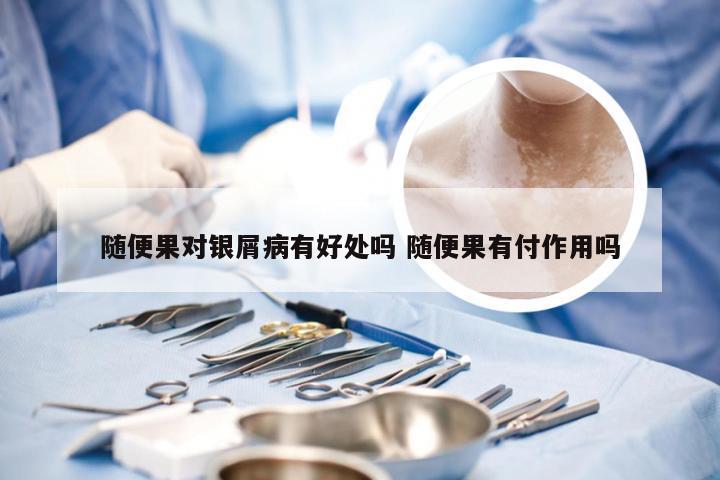 随便果对银屑病有好处吗 随便果有付作用吗