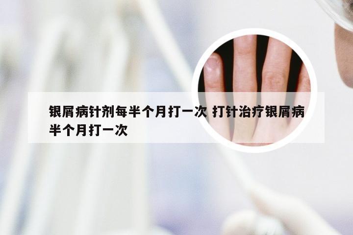 银屑病针剂每半个月打一次 打针治疗银屑病半个月打一次
