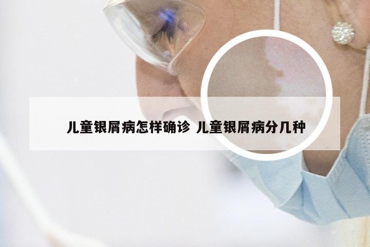 儿童银屑病怎样确诊 儿童银屑病分几种